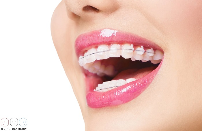 Nha khoa nào chuyên điều trị răng vẩu?